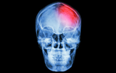 Scientific Head Injury Day