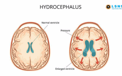 Hydrocephalus & Neural Tube Defects Workshop